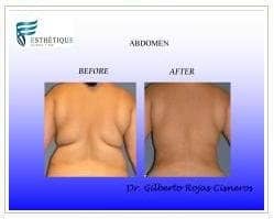 Slider image (4) Esthetique Clinic and Spa